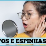 Cravos e espinhas: O que fazer? Quais as diferenças?