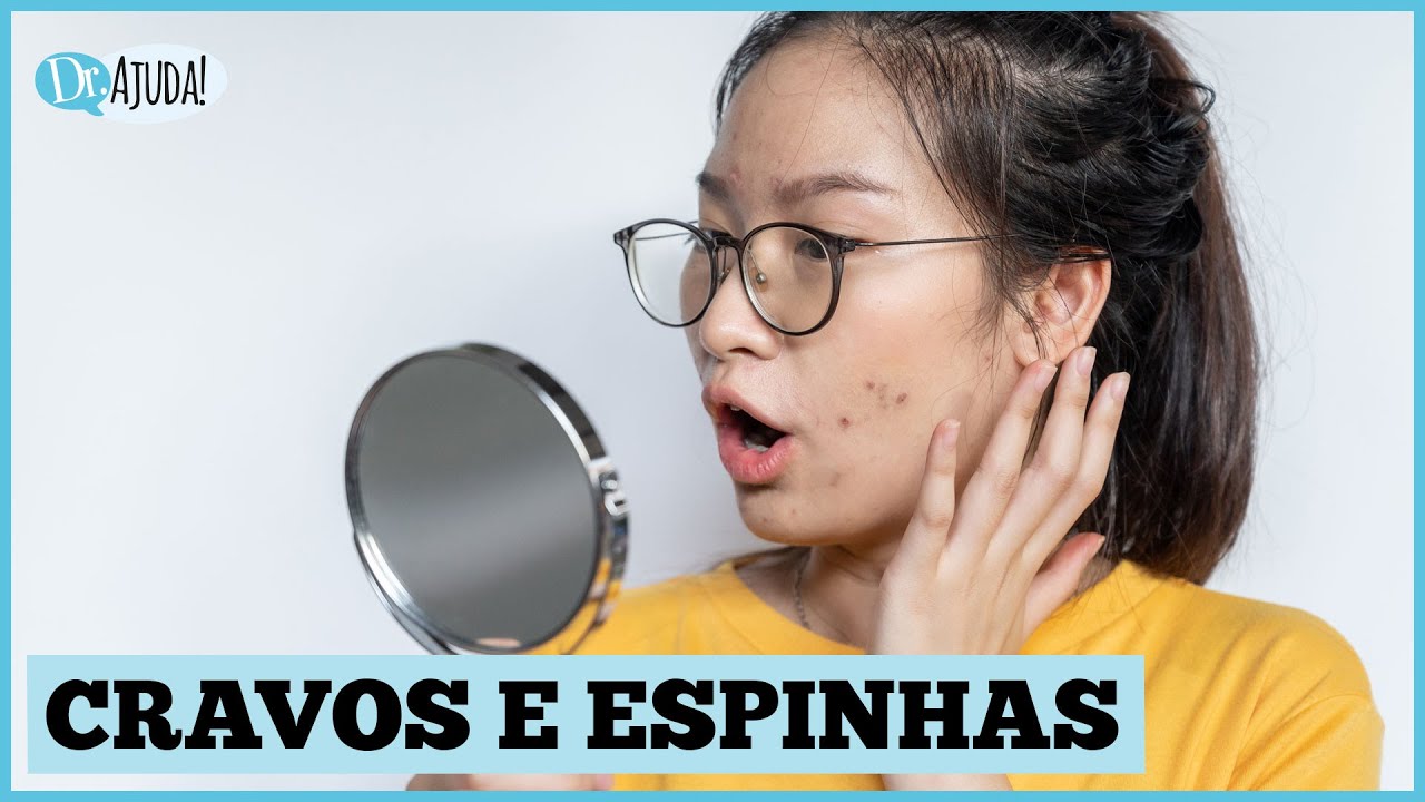 Cravos e espinhas: O que fazer? Quais as diferenças?