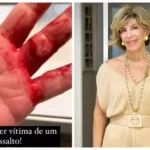 Silvia Poppovic é vítima de assalto em SP — Foto: Reprodução/Redes Sociais