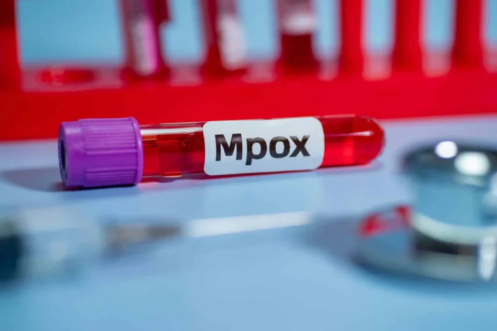 Mpox não é a nova COVID-19