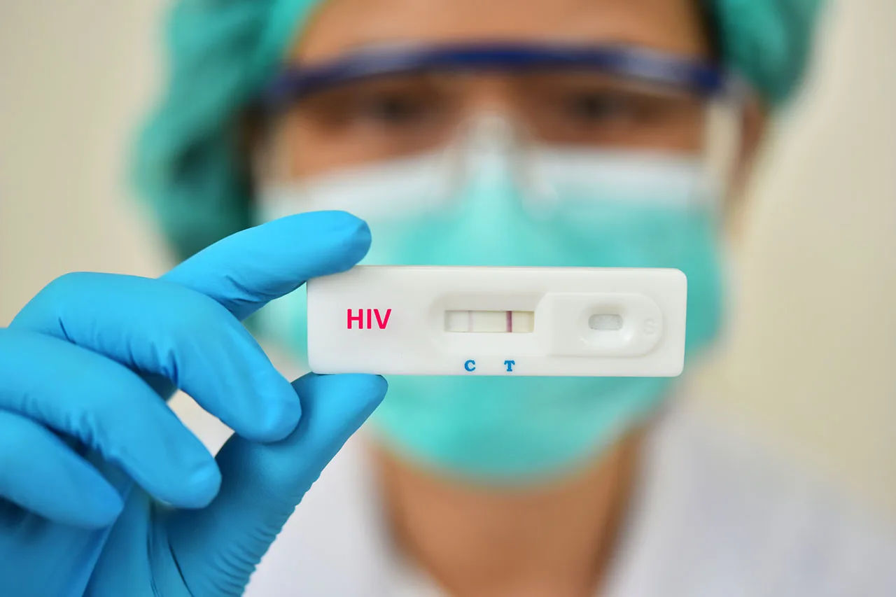 Nova variante do HIV no Rio