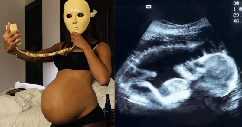 A cantora compartilhou fotos grávida e de uma ultrassom misteriosa – Foto: Anitta/Instagram