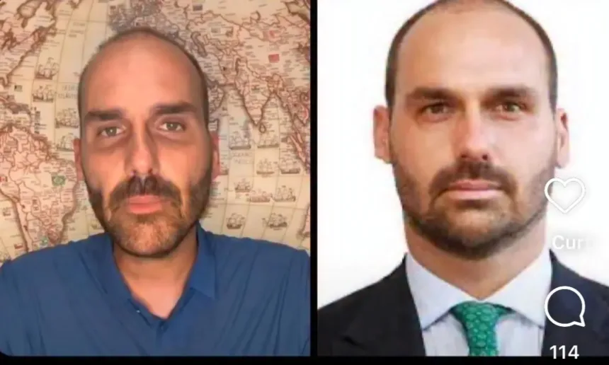 Eduardo Bolsonaro: internautas começaram a comentar a aparência mais magra e o formato do rosto do político, que muitos consideraram “cabeçudo” – Foto: Reprodução